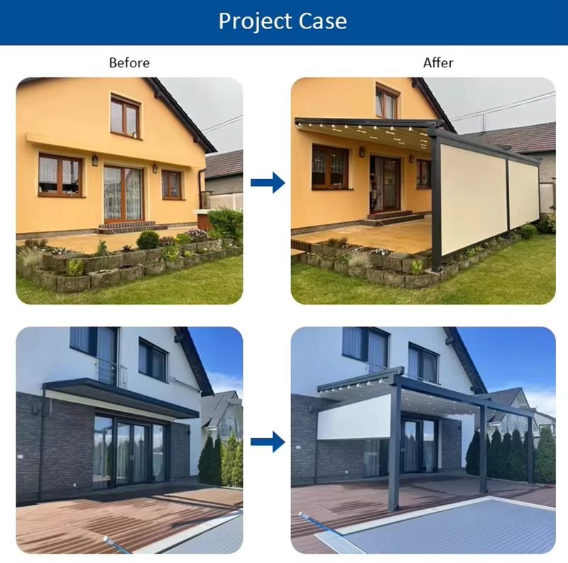 Pergola Retractable Awnings